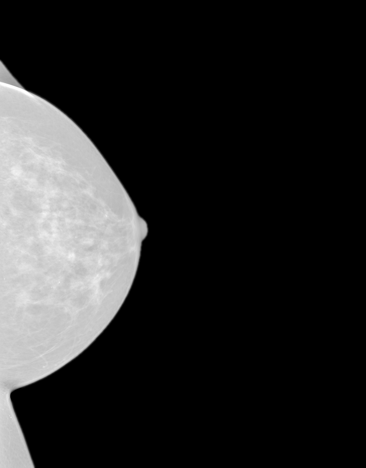 Automation for Cancer Screening
